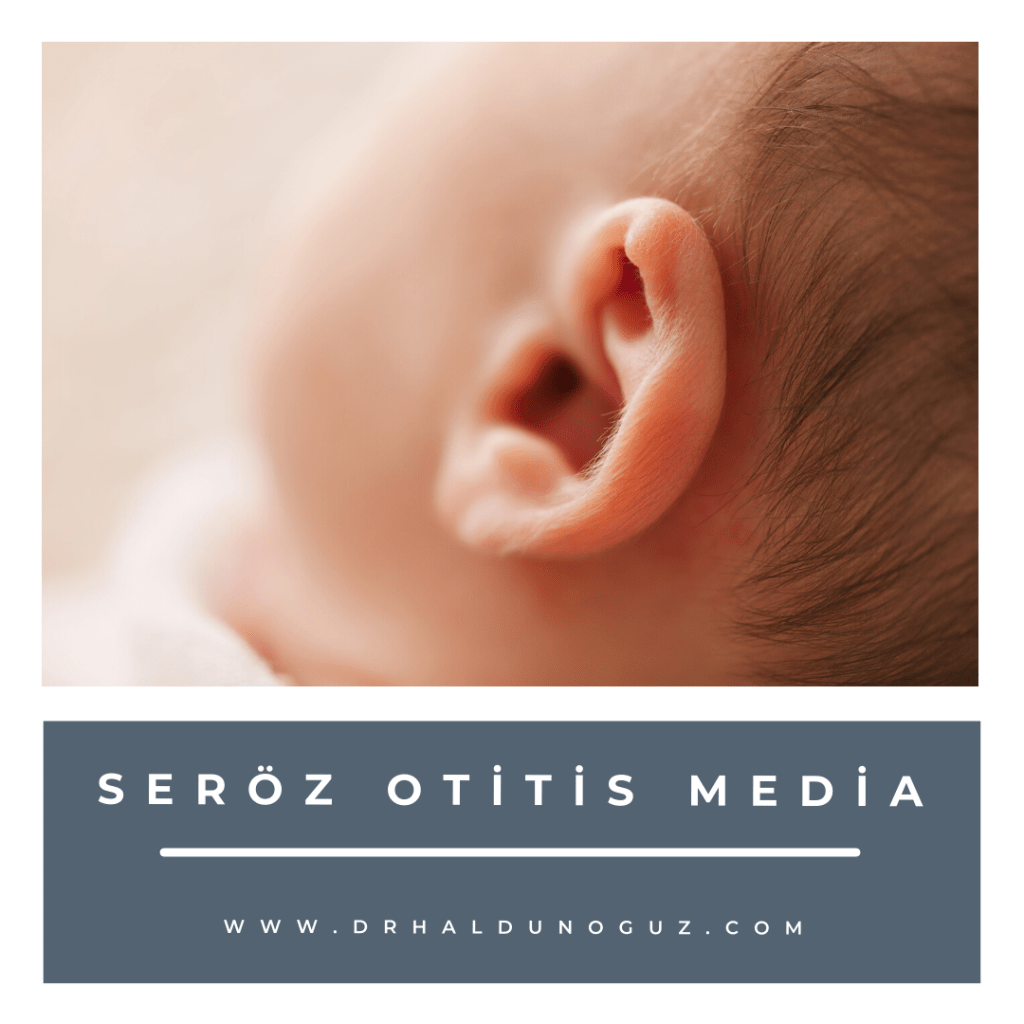 seroz-otitis-media