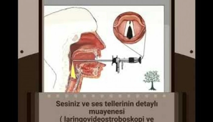 ses ameliyatı,ses cerrahisi,ses teli felci,ses tedavisi,ses terapisi,ses inceltme,ses kalınlaştırma,ses estetiği,ses teli kanseri,gırtlak kanseri,geniz eti,burun ameliyatı,kulak tüpü,çocuk kbb,horlama ameliyatı,kulak burun boğaz profesörü,an